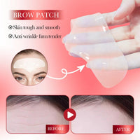 Cureluxe Forehead Wrinkle Patches