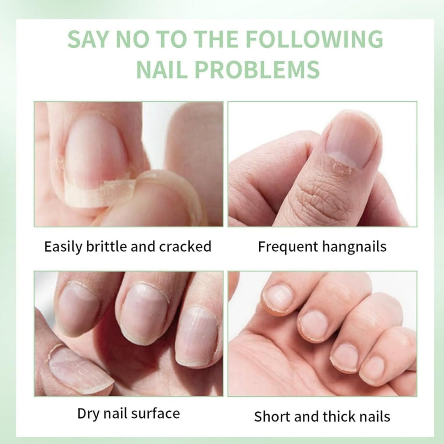 2pcs Radiant Nail Growth Oil,Cuticle Moisturizer & Nail Strengthener with Vitamin E Cuticle N/ail Oi/l,Radiant N/ail Growth O-il Pen,Cuti-cle Oi/l Pen for Nails,Nail-Oil Treatment for Damaged Na-ils