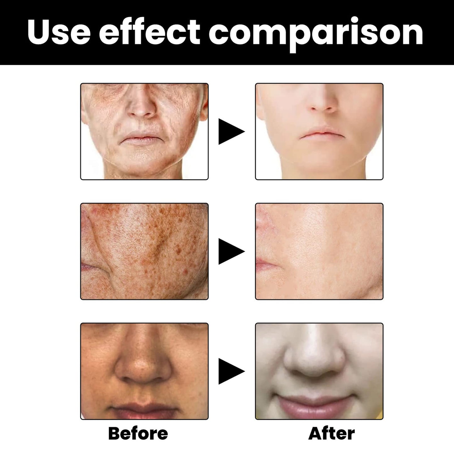 Dark Spots Correcting Facial Serum,2PCS Brightening Facial Serum,Rapid Dark Spot Correcting Serum,Improve Dry Skin & Smooth Skin,Brightening Serum,Dark Spot Remover Serum For Melanin Correcting