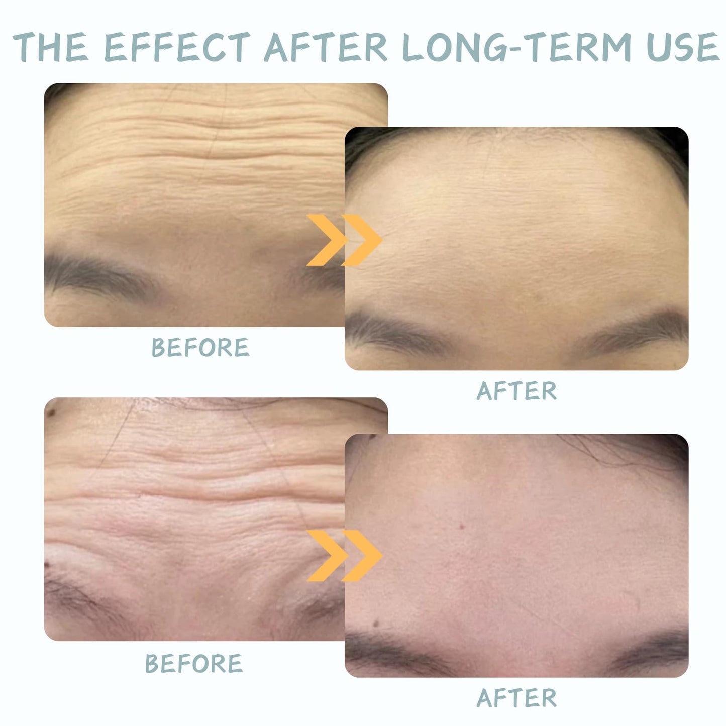 Cureluxe 20 Packs Forehead Wrinkle Patches - Face Wrinkle Patches - Anti Wrinkle Patches with Aloe, Collagen Hyaluronic Acid - Forehead Stick for Facial Lines Remover (2 Boxes)
