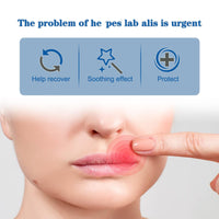 Cold Sore Cream,Cold Sore Treatment Cream,Mouth Ulcer Treatment for Adults,Gentle Sore Lips Treatment,Mouth Sore Treatment for Lips,Mouth Ulcer Gel,Fresh and Non-irritating,Natural Ingredients,20g