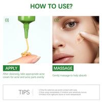 Anti Acne Face Cream, 3X Centella Face Ance Gel, Spot Cream for Acne Treatment and Spot Treatment Shrink Pores, Acne Scars Recovery, Control Sebum Secretion, Relieves Redness &Anti-Bacterial