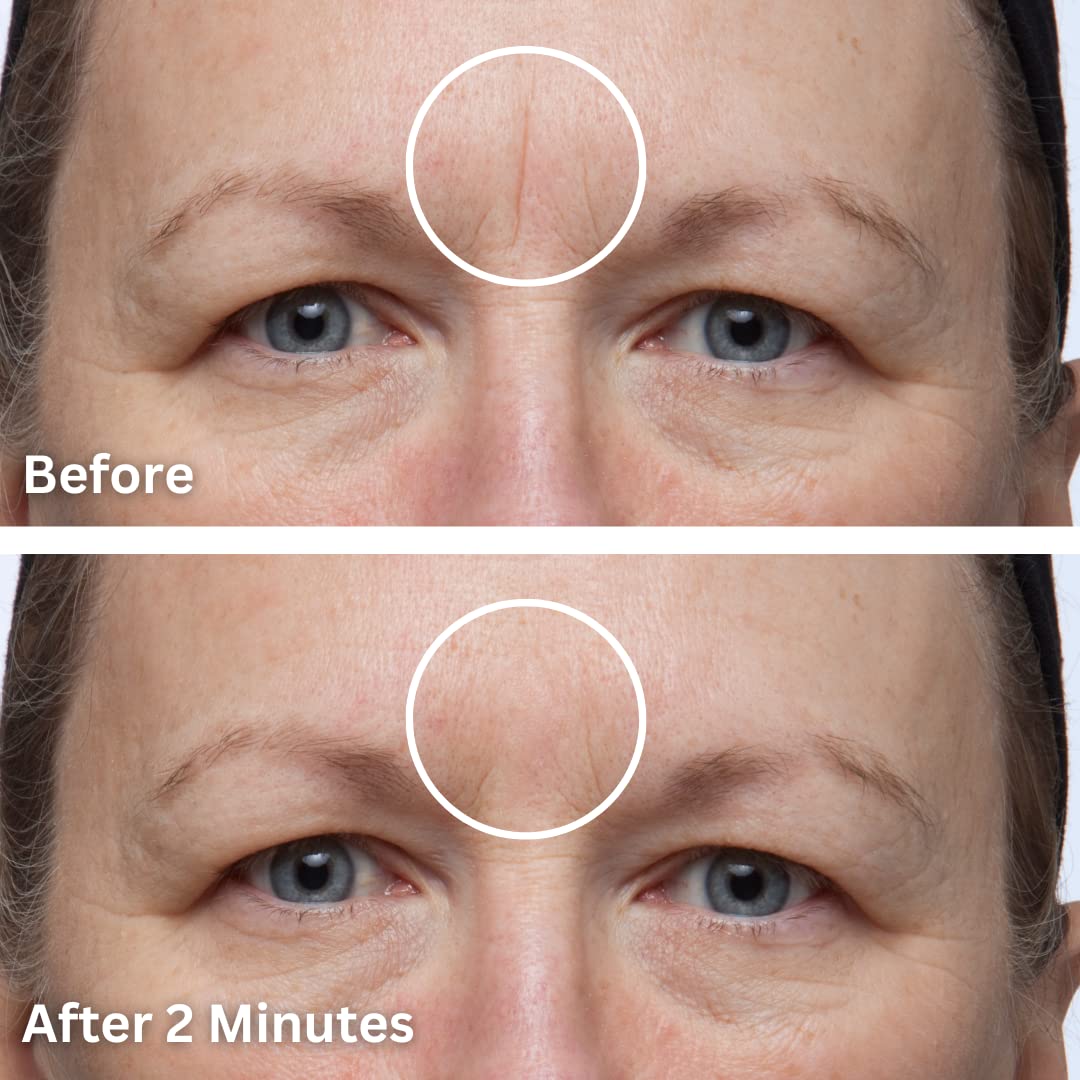 Dermaflage Cover Up - Concealer for Scars, Frown Lines from Hollywood Pro