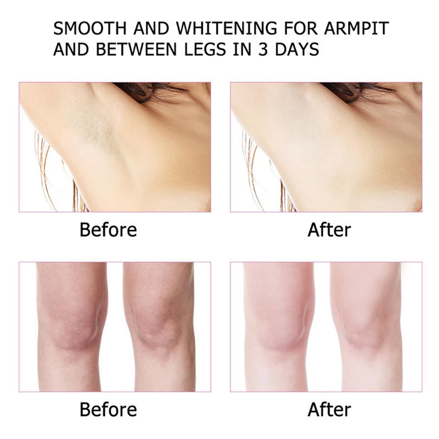 Korean Skin Care, Kojic Acid Skin Cream, Underarm Cream For Intimate Area, Private Parts, Knees, Elbows, Inner Thigh, Bikini Areas, Cream Quickly Absorb & Reduce Odor,Smoothing.