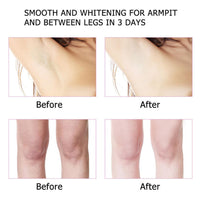 Korean Skin Care, Kojic Acid Skin Cream, Underarm Cream For Intimate Area, Private Parts, Knees, Elbows, Inner Thigh, Bikini Areas, Cream Quickly Absorb & Reduce Odor,Smoothing.