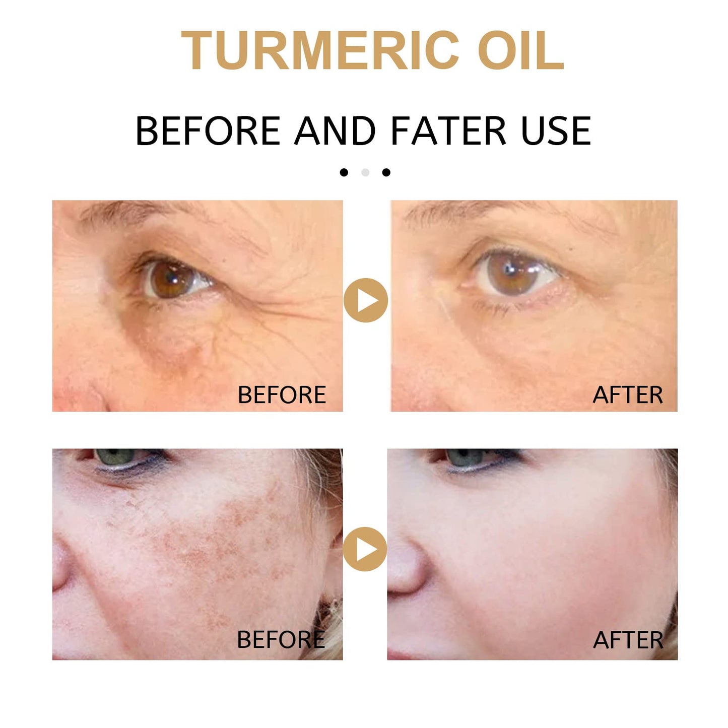 INSKIN Turmeric Dark Spot Corrector 2 Pack Serum Face Serum Bright Skin Dark Spot Corrector Face Whitening Serum Turmeric Repair Face Body Serum for Dark Spots Skin Lightening Moisturizing (2PCS)