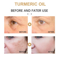 INSKIN Turmeric Dark Spot Corrector 2 Pack Serum Face Serum Bright Skin Dark Spot Corrector Face Whitening Serum Turmeric Repair Face Body Serum for Dark Spots Skin Lightening Moisturizing (2PCS)