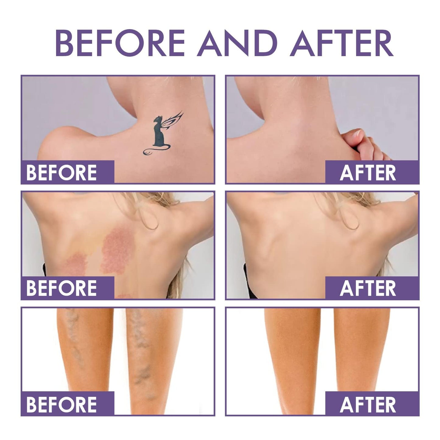 Concealer Cream, Waterproof Cover Cream, Conceal Spider Veins, Tattoos, Scars - Leg & Arm Make-Up, Foundation - 1 Pcs