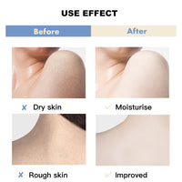 CTUBLIAUNX Essential Oils for Skin - Turmeric Body Oil - Turmeric Oil for Acne, Dark Spots and Smooth Skin, Pure Extracts Massage Oil, Deeply Hydrating and Easily Absorbed Moisturiser