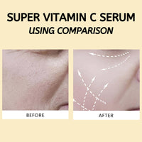 Tongyend Super Vitamin C Serum for Mature Skin, Antioxidant Vitamin C Serum for Glowing Skin, Anti-Aging & Brightening Face Serum for Wrinkles, Vitamin C Serum for Women Over 45, Targets Age Spots