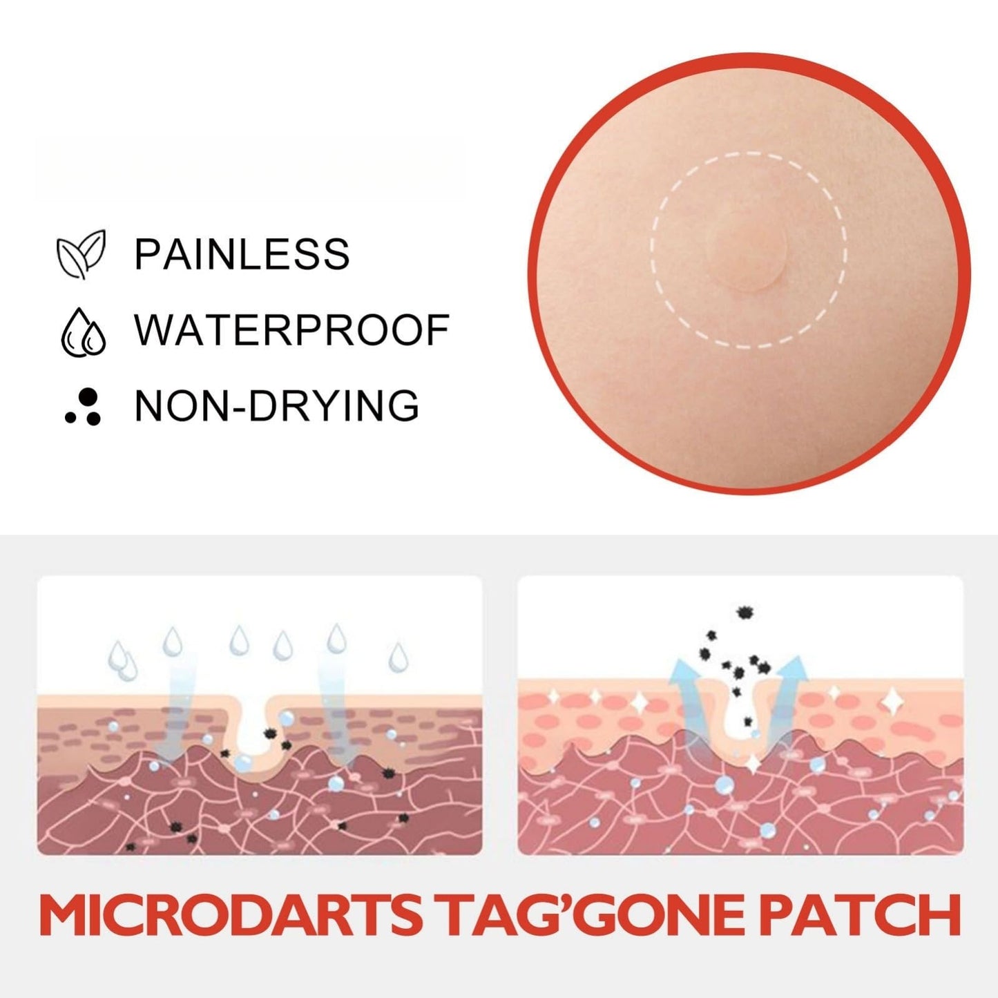 SingHao 144 Pcs Microdarts Tag'gone Patch,Pimple Patches,Spot Patches,Acne Treatment,Invisible Blemish Cover Spot Sticker,Patches Pimple Stickers Acne Dots,Pimple Spot Stickers Day&Night Use(144Pcs/box)