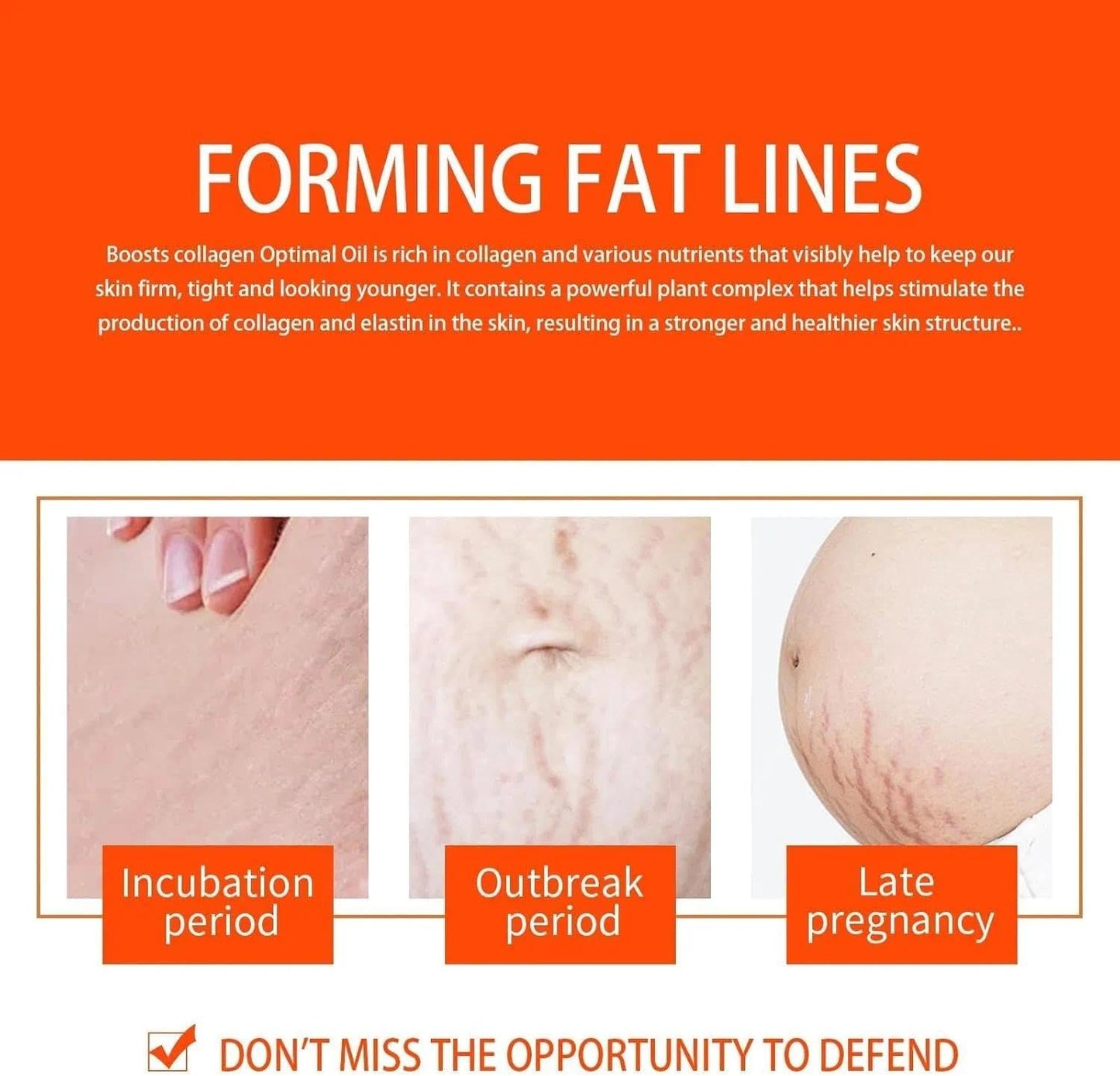 Natrcollor 2 PCS Stretch-Mark Scar Treatment Oil, Collagen Boosting Firming & Lifting Skincare for Women. Helps Remove Stretch Marks & Scars, 250 ml