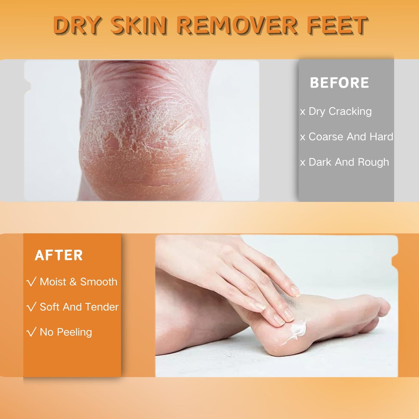 3pcs Moisturizing Hand & Foot Cream for Very Dry Skin - Cracked Heel Repair, Athletes Foot Care with Manuka Honey, Fast Absorption, Anti Dryness & Anti Crack, Portable Daily Size (1.41 oz)