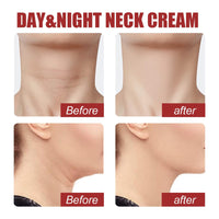Siyinzu Neck Firming Cream,Tighten and Lift Neck Cream,Anti-Aging Neck Cream,Nec/k Moisturizer Cream,Skin Firming Cream for N/eck Tightening,Ne/ck Firming and Repair Cream,Smoothes Fine Lines & Wrinkles