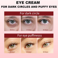 IZBEAUVO Caffeine Eye Cream, Eye Cream Anti Aging,Dark Circle Eye Cream,Eye Bags Remover Of Caffeine Eye Serum, Eye Cream For Dark Circles,Fade Fine Lines,Puffy Eyes Bags Under Eyes,Anti Wrinkle