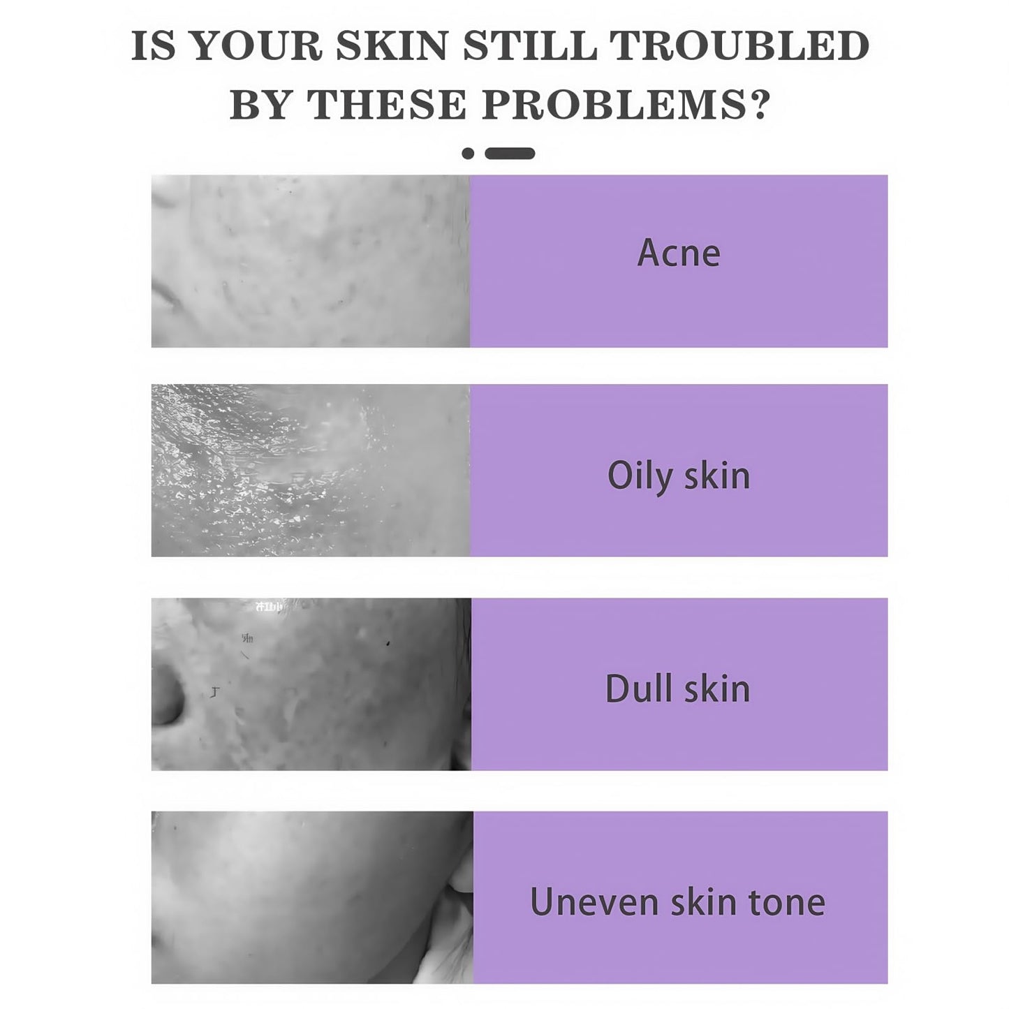 Fankayi Azelaic Acid Serum Cream,Face Hyaluronic Acid for Redness & Dark Spots,Brightening Face Skin Care Treatment,Dark Spot Remover,Brightening Serum,Whitening Freckle Cream,Dark Spot Correcting Serum