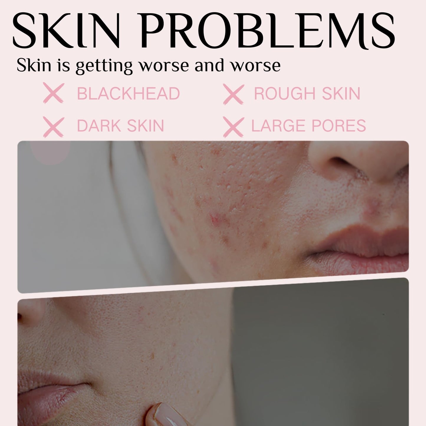 Purifying Exfoliating Gel - face scrub exfoliator - Facial Scrub - Exfoliating Gel for Face For Women - Face Skin Care Deep Cleansing Even Skin Tone Soft Skin 50g