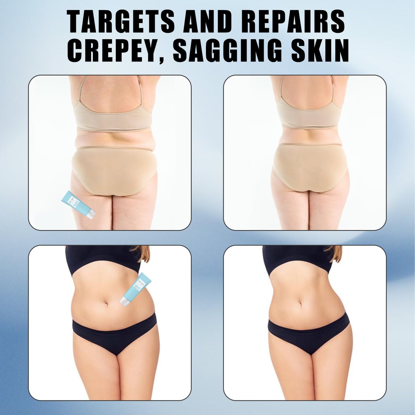 Nadiaen Skin Firming Youth Butter,Skin Firming Cream,Skin Firming Body Cream,Skin Tightening,Suitable for Sagging Skin,Used for Anti-Aging,Firming,Improving Wrinkles and Reducing Skin Dryness (80ml×2)