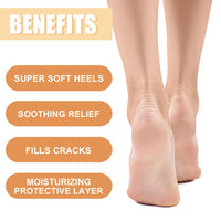 Honey Foot Cream,Hand & Foot Cream for Very Dry Feet & Hands,Cracked Heel Repair Cream,Foot Mask,Foot Moisturiser,Hard Skin Remover,He/el Balm for Cracked H/eel,Feet Cream,F/oot Balm