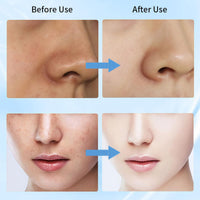 OuXing Dark Spot Remover for Face and Body,Dark Spot Remover Serum,Dark Spot Corrector,Sun S/pot and Age S/pot Remover,Freckle Removel Cream,Hydrating Serum,Brightening Serum,Skin Serum,Facial Serum