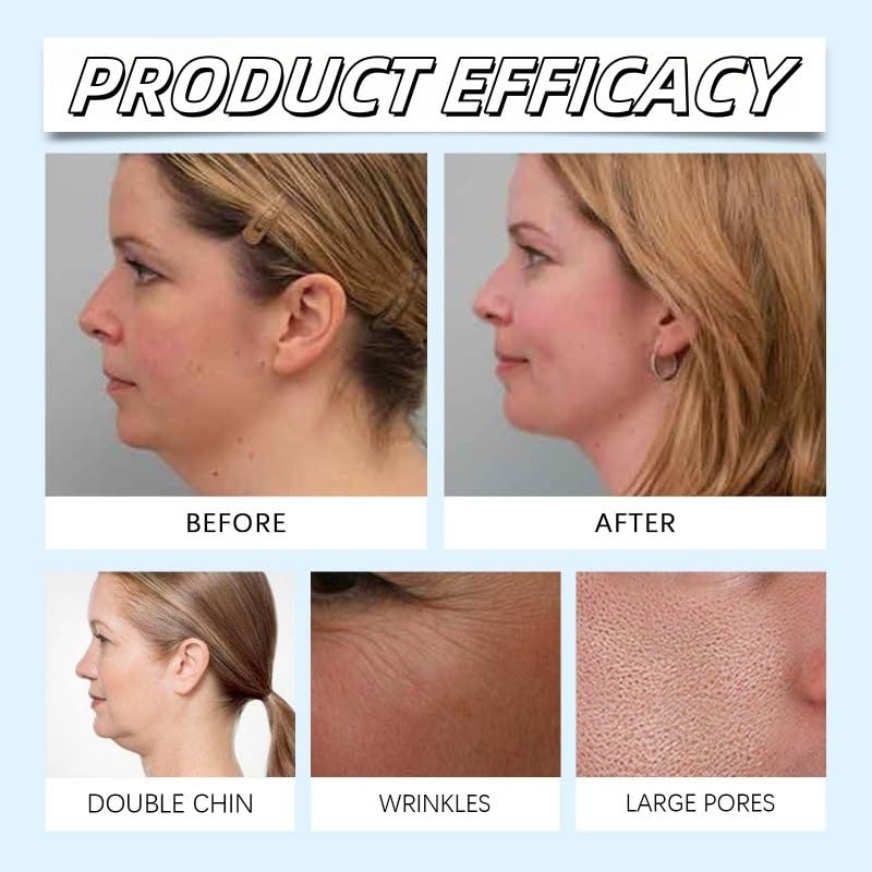 Chinology Double Chin Lifting Mask, 2pcs Chinology Chin Mask, V-line Face Lift Chin Mask, Anti Aging Collagen Face Mask for Double Chin Reducer - Say Goodbye To Your Double Chin Now