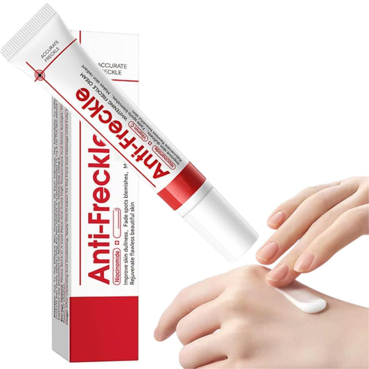 FHRKZZ Freckle Cream Vitamin C Freckle Cream for Adults with O+ Technology, Fades Dark Spots & Sun Spots, Brightens Dull Skin, Spot for Women - Improve Skin Dullness, Fade S-pots Blemishes