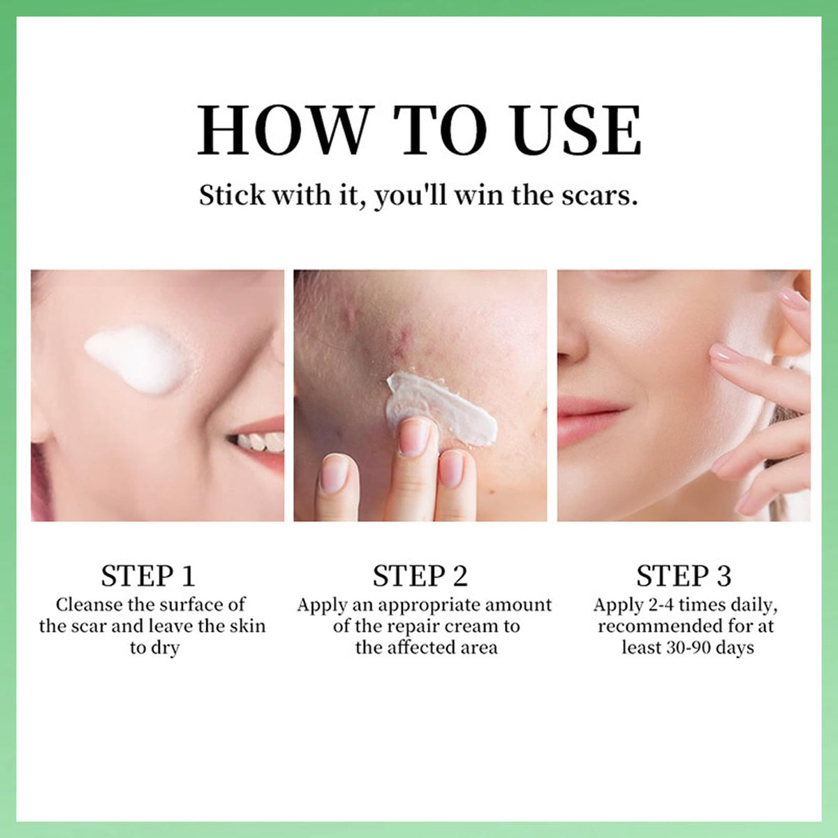 MINSHZEE Scar Removal Cream for Face & Body - Treatment for New Scars, Stretch Marks, Acne Spots & C-Sections Treatment Cream, 50g, Natural Formula for Face and Body, Reduces Old and New Scars