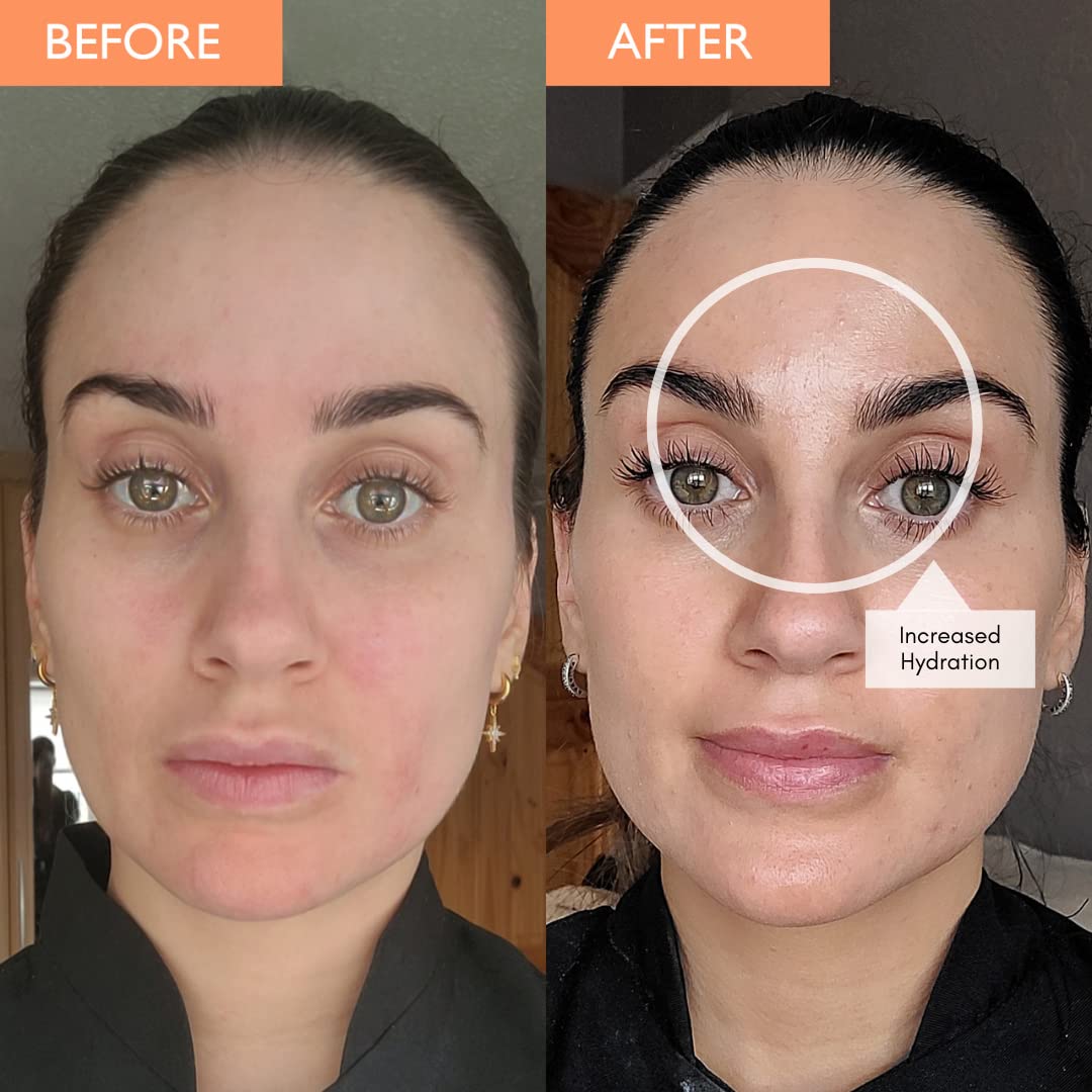 SKINICIAN Vitamin C Elixir 15ml - Anti Wrinkle & Brightening Face Serum with Avocado Oil - Collagen-Boosting Vitamin C Serum for Radiant, Plump Skin - Reduces Age Spots & Fine Lines