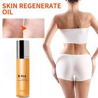 SingHao B Fl/at Belly Firming Cream,Stretch Mark & Scar Treatment Skincare Cream,Skin Firming and Tightening Body Cream,Skin Tightening Moisturizing,Skin Regenerate Cream,Stretch Marks Removal