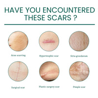 Jinjiar Scar Cream,Scar Removal Cream,Advanced Scar Gel for Old and New Scars,Skin Repair Cream for Old and New Scars,Scar Erase,Acne Scar Treatment,Scar Cream After Surgery,Scar Removalscar Cream for Face