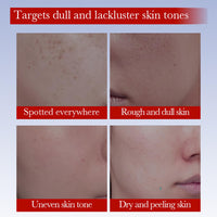 ISBEAUSOLS Freckle Removal Cream - Dark Spot Removal Cream with Niacinamide & Vitamin C - Dark Spot Re-mover for Face - Spot C-ream for Women - Melasma C-ream - Improve Skin Dullness, Fade S-pots Blemishes