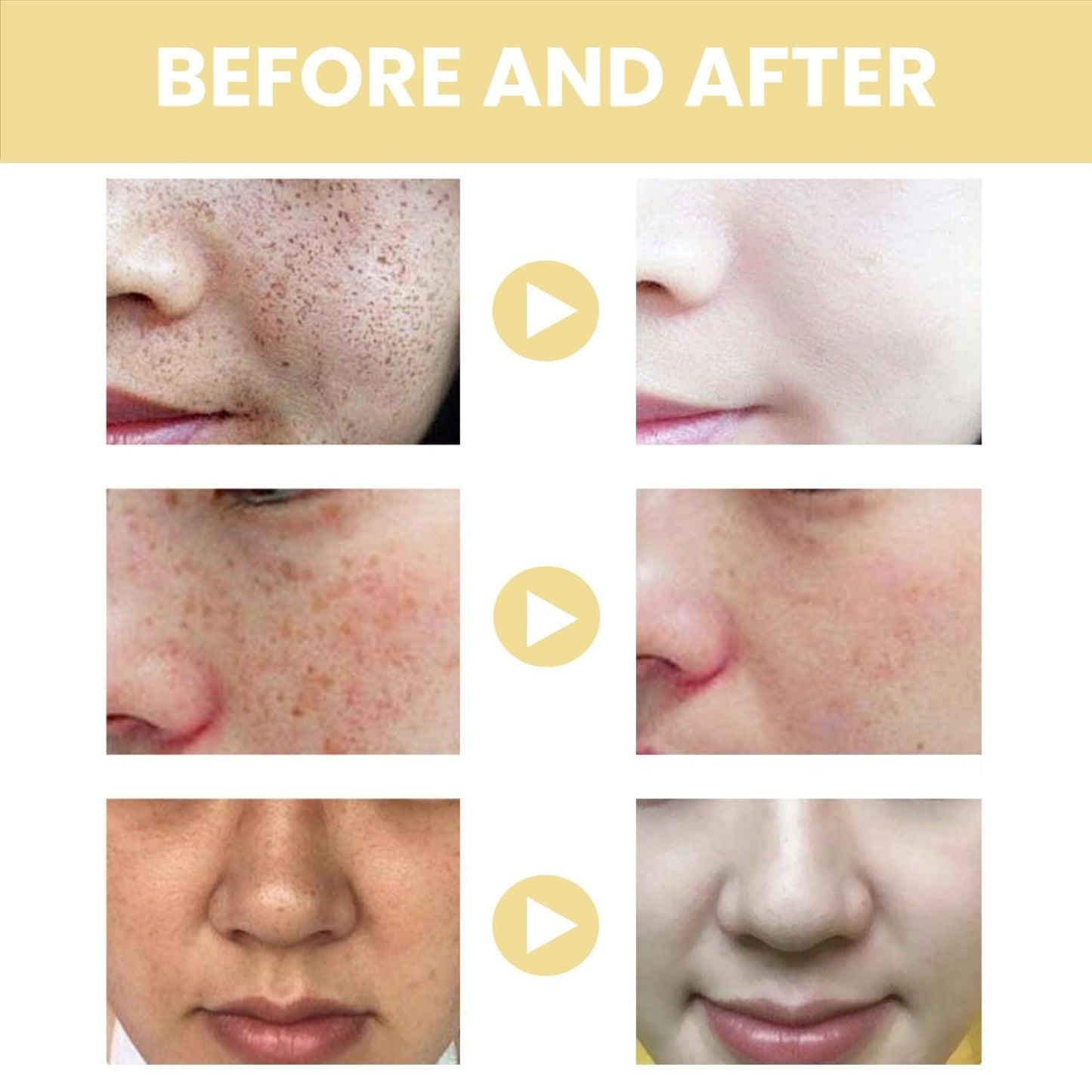 SingHao 7-Day Rapid Skin Repair Cream,Be/e Ve/nom S/kin C/ream,Sk/in Care Cream,Dark Spot Remover,Anti Wrinkle Face Cr/eam,Anti Aging Face Cre/am,Freckle Removal Crea/m,Lightening Cream,Lifting & Repairing