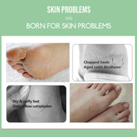 5 Pairs Mint & Tea Tree Foot Peel Mask – Exfoliating Foot Mask for Dry, Cracked Heels – Foot Care Socks for Women & Men - Softens Hard Skin & Hydrates for a Pampering Effect