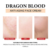 Dragons Blood Easy Cream, Retinol Placenta Dragon Blood Cream, Skincare Face Repairs Skin Firm Anti-wrinkle Cream, Moisturizer Nourishing Rejuvenating Cream