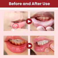OuXing Cold Sore Treatment Cream,Cold Sore Cream,C/Old S/ore Treatment,C/Old S/ore C/Ream for Lips,Co/ld So/re Relief C/Ream,So/re Lips T/reatment,Mouth SOR/e T/reatment,Oral Gel Extra Strength,Lip Care