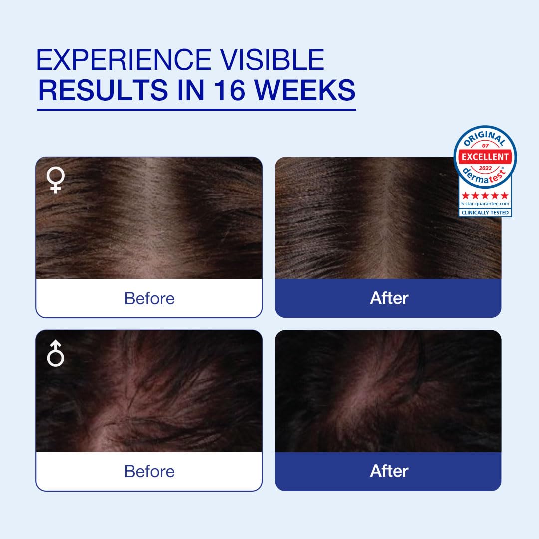 COSMERNA CosmeRNA Hair Revitalizing Tonic 2ml with Once a week Application for Healthy Hair for Women and Men