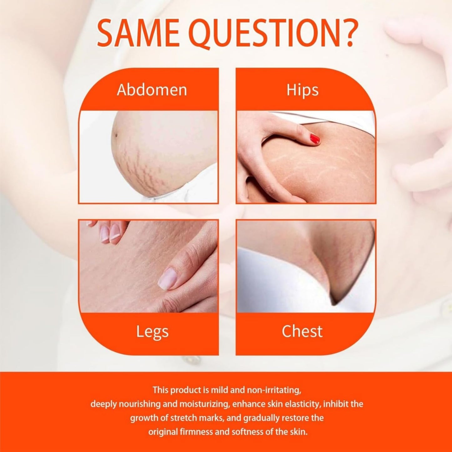 SingHao B Fl/at Belly Firming Cream,Stretch Mark & Scar Treatment Skincare Cream,Skin Firming and Tightening Body Cream,Skin Tightening Moisturizing,Skin Regenerate Cream,Stretch Marks Removal
