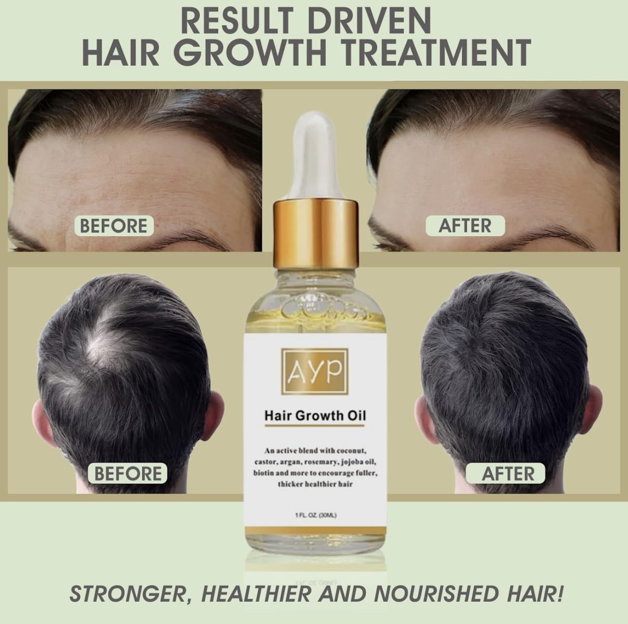 AYP Distribution Hair Growth Serum with Organic Oils, Rosemary, Castor, Argan, Avocado, Coconut & Jojoba, Biotin for Thickening & Loss Prevention