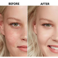 AuraBeen 4-in-1 Serum, Vitamin C, Hyaluronic Acid, Vitamin E & Niacinamide, Targets Pigmentation & Signs of Aging, 30ml