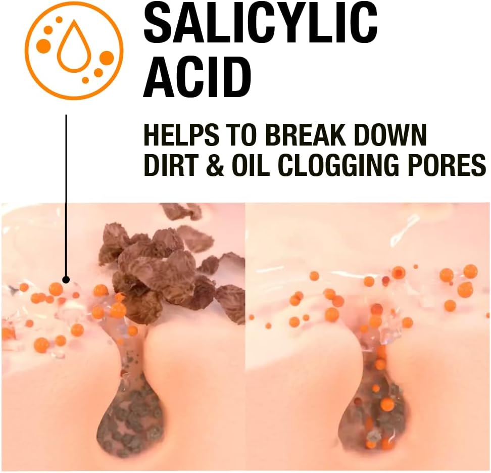 Neutrogena Blackhead Eliminating Facial Scrub, Clear, 150 ml / 5 fl oz