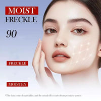 FHRKZZ Freckle Cream Vitamin C Freckle Cream for Adults with O+ Technology, Fades Dark Spots & Sun Spots, Brightens Dull Skin, Spot for Women - Improve Skin Dullness, Fade S-pots Blemishes