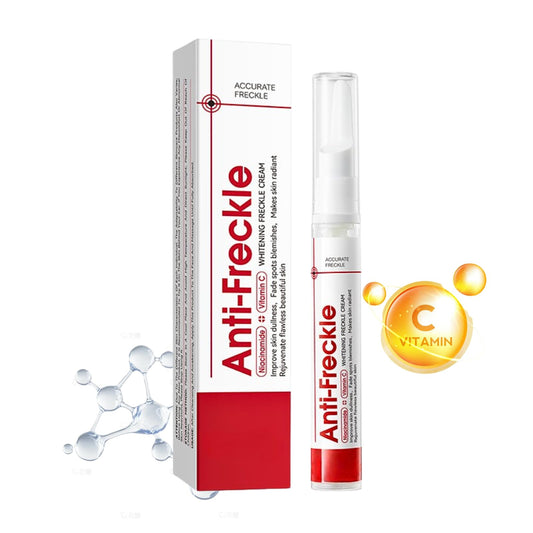 IZBEAUVO Freckle Removal Cream with Niacinamide&Vitamin C–Dark Spot Remover for Face,Dark Spot Corrector,Reduces Age Spots,Melasma,Sun Spot,Blemish,Improve Skin Tone,for All Skin Types,15g