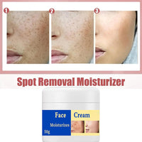 GNAUMORE Spot Remover For Face Serum,Dark Spot Corrector Cream,Sun Spots and Melasma Freckle Remover,Spot Remover For Face Serum,Sun Spots and Melasma Treatment Cream for Face 50G