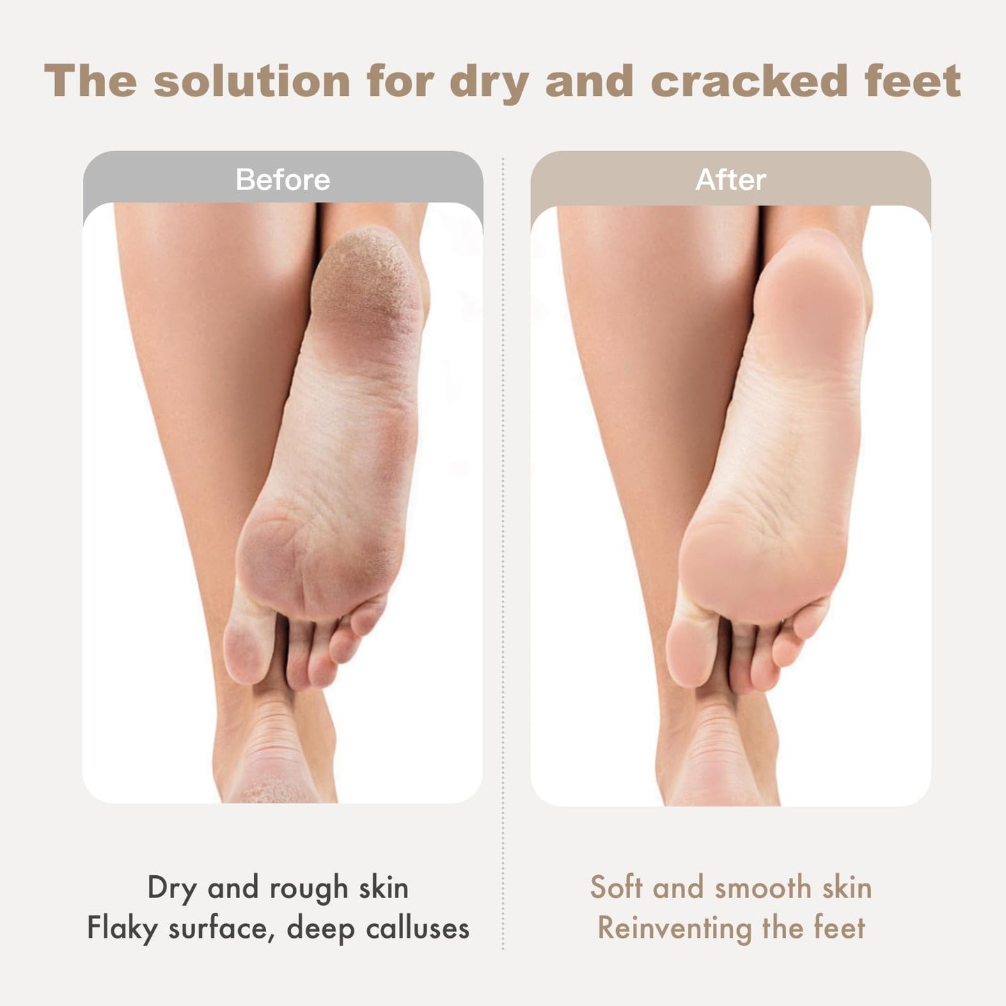 CTUBLIAUNX Cracked Heel Repair Cream with Manuka Honey – Foot Cream for Cracked Heels & Dry Skin, Fast-Absorbing Moisturizer for Rough, Peeling Feet