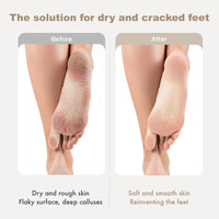 CTUBLIAUNX Cracked Heel Repair Cream with Manuka Honey – Foot Cream for Cracked Heels & Dry Skin, Fast-Absorbing Moisturizer for Rough, Peeling Feet