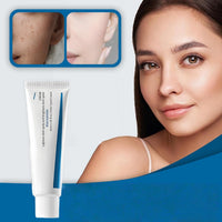 Dark Spot Cream,Anti Aging Face Cream for Freckles&Hyperpigm/entation,Spot Treatment,Skin Tightening Cream for Face,Skin Whitening Cream,Trane/xamic Acid&Niacinamide Facial Moisturizer,Gentle Formula