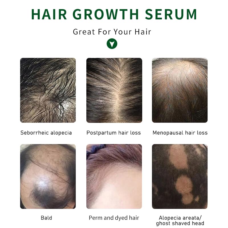 PrimeCove - Biotin & Tea Tree Hair Growth Serum (30ml) | Stimulate Growth, Reduce Graying & Nourish Roots | Advanced & Natural Formula