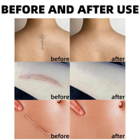 Jinjiar Leg Makeup Waterproof No Transfer,Leg Vein Cover up Makeup,Leg Makeup Lotion,Leg and Body Scar Cover Up Makeup,Concealer Full Coverage,Makeup Concealer,Leg Makeup,Lasting Perfection Concealer(1#)
