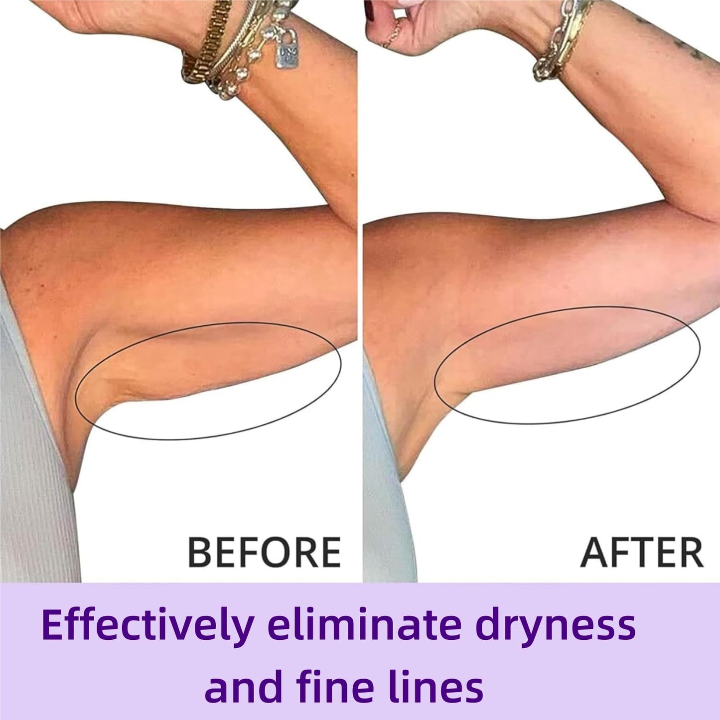 Sculpt And Tone Arm Cream,Firming Body Cream,Firming Cre-Am For Loose Skin,Upper Arm Fir-Ming Cre-Am,Tighting Balm For Loose Skin,Smooth,Deep Moisturizing And Hydrating,Suitable For Sensitive