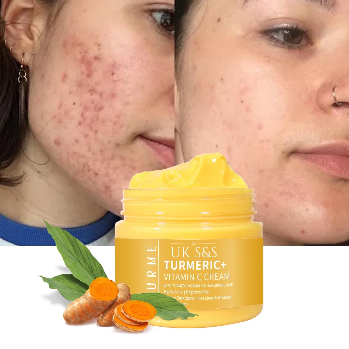 Turmeric & Vitamin C face cream. Anti-aging cream that reduces dark spots and brightens skin. Heals acne and repairs damaged skin. Soften and smoothens skin.